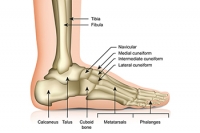 Causes of a Stress Fracture