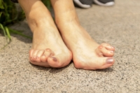 Common Symptoms of Rheumatoid Arthritis in the Feet